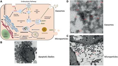 Skeletal Muscle-Released Extracellular Vesicles: State of the Art